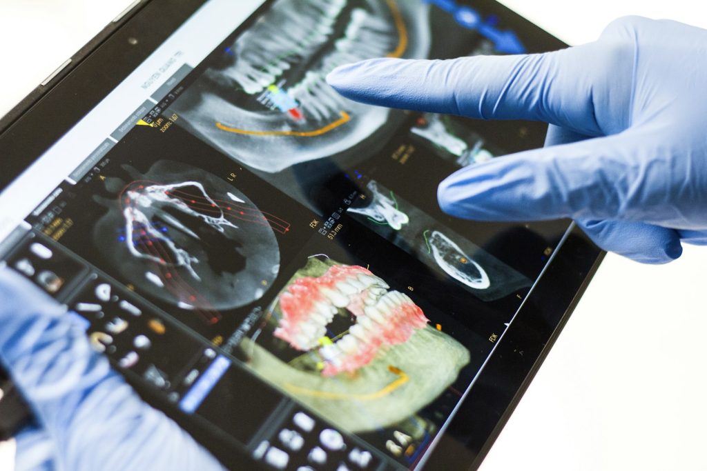 Εξέταση οδοντιατρικής απεικόνισης σε tablet